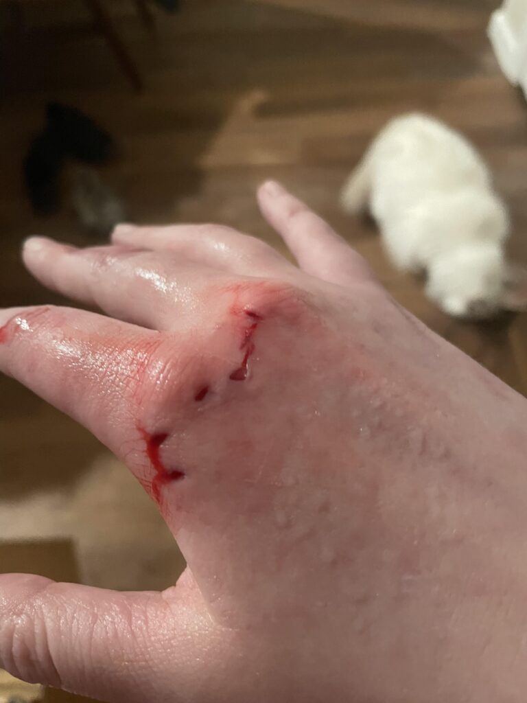 A photo of a human hand showing four red puncture wounds from a raccoon bite showing the physical damage exotic pets can do